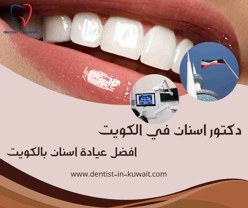افضل عيادة اسنان بالكويت
