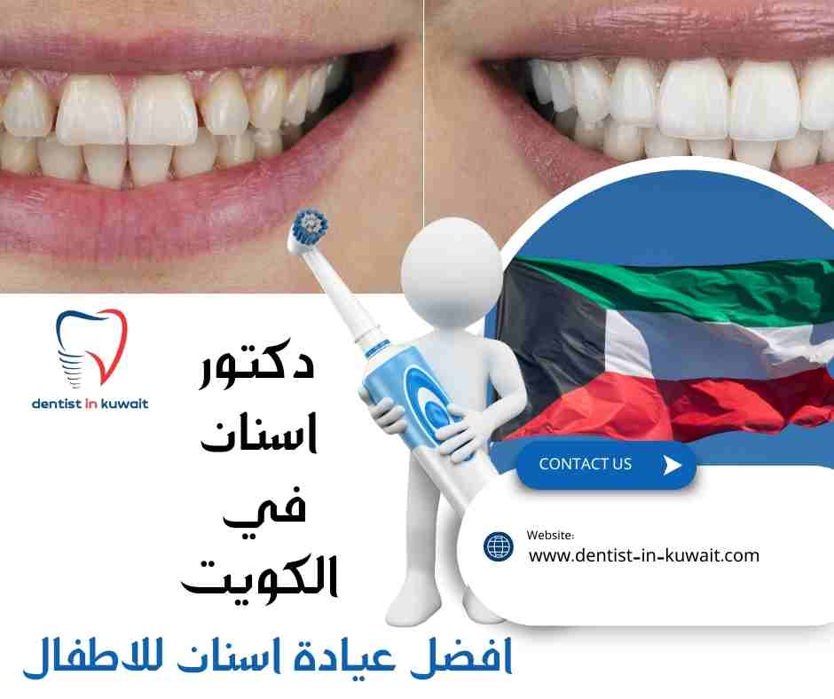 افضل عيادة اسنان للاطفال بالكويت