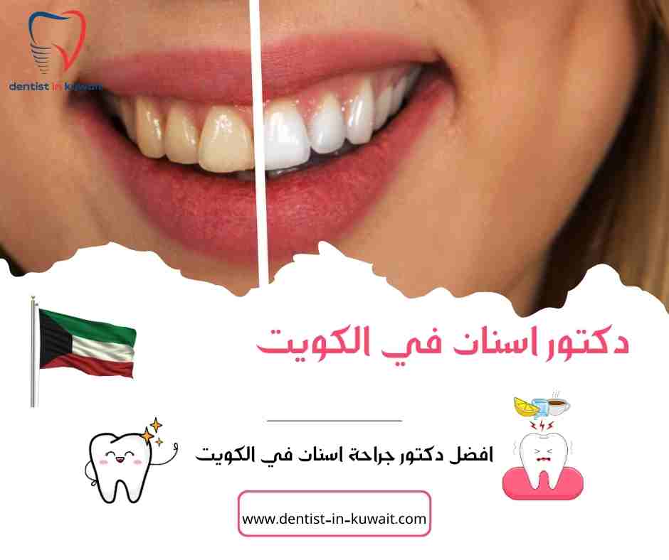افضل دكتور جراحة اسنان في الكويت