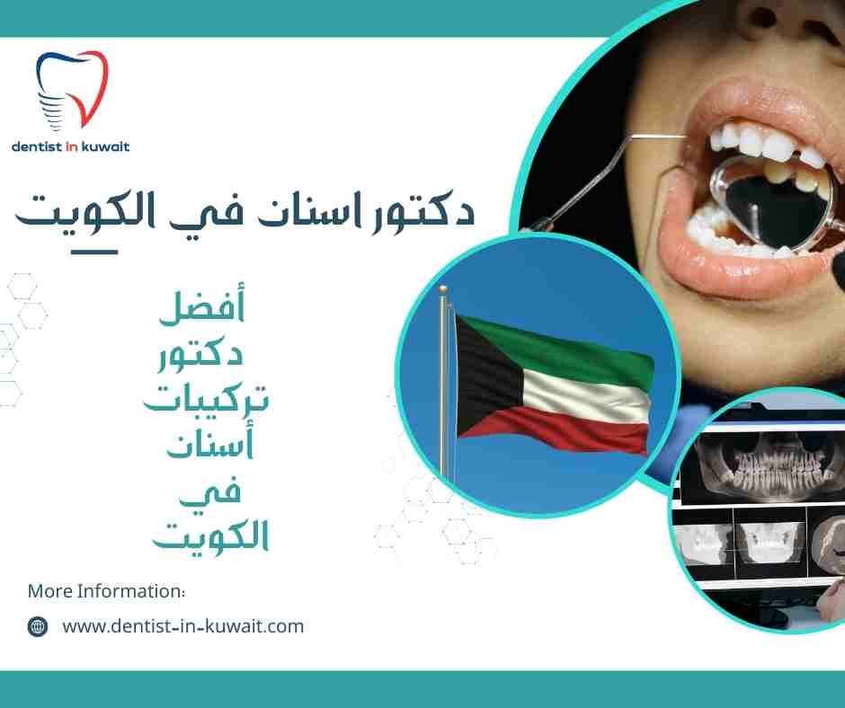 أفضل دكتور تركيبات أسنان في الكويت