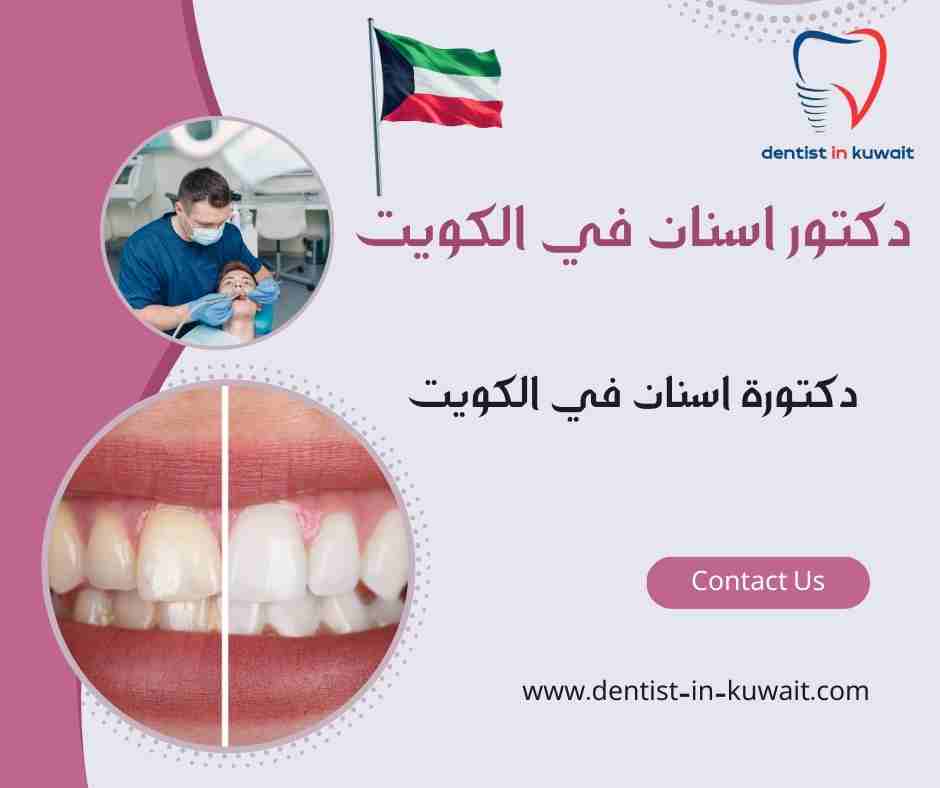 دكتورة اسنان في الكويت
