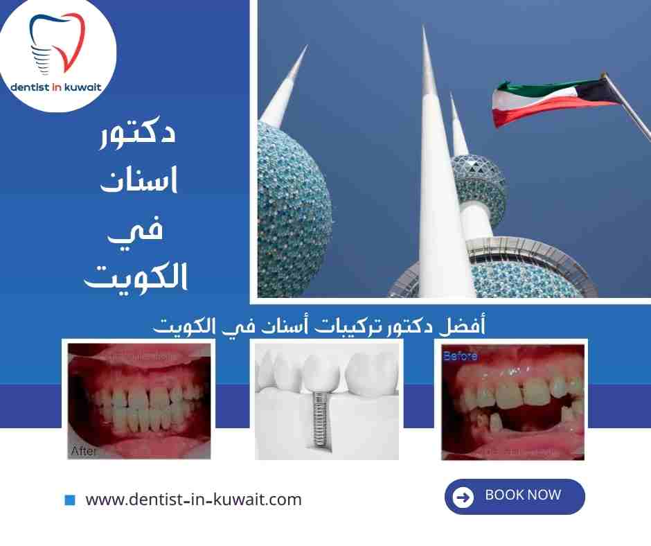 أفضل دكتور تركيبات أسنان في الكويت