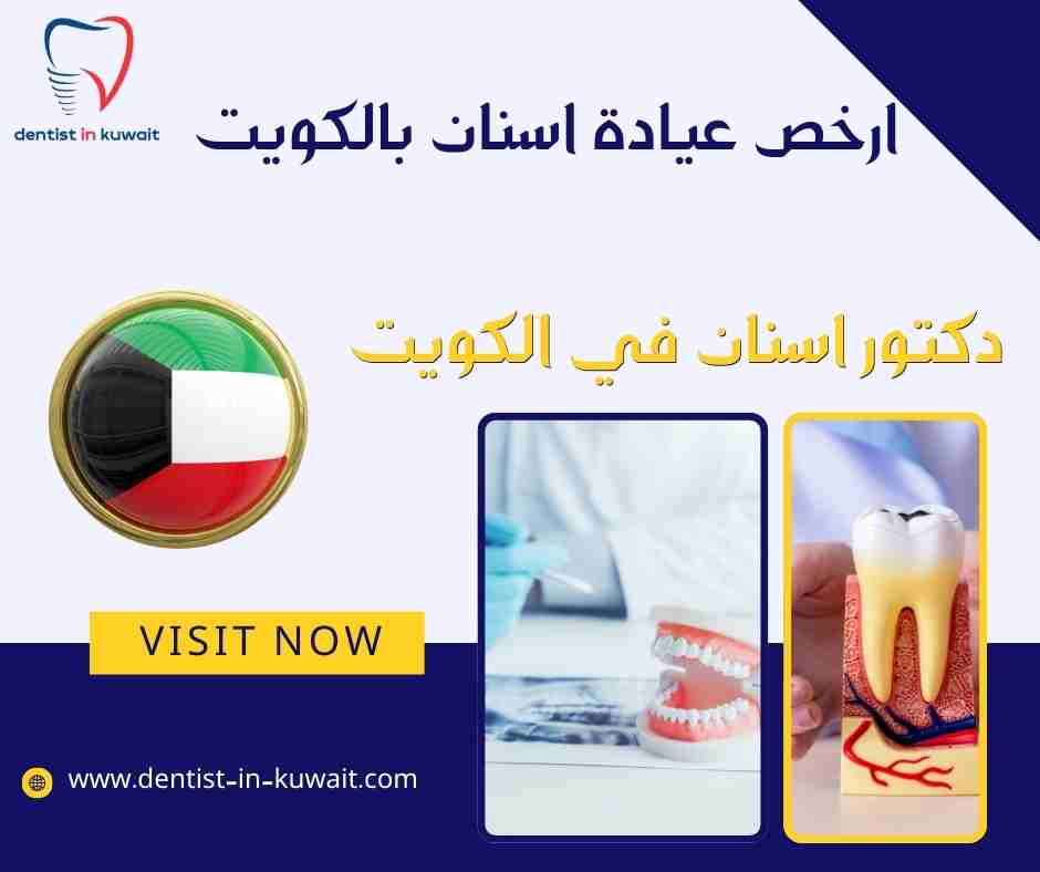 ارخص عيادة اسنان بالكويت
