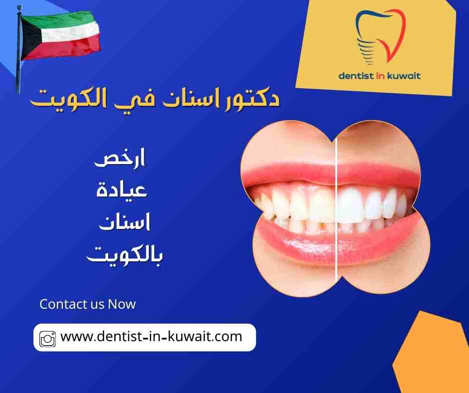 ارخص عيادة اسنان بالكويت