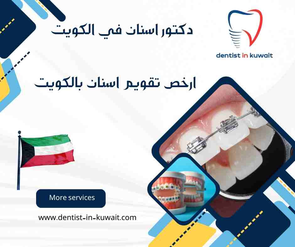 ارخص تقويم اسنان بالكويت