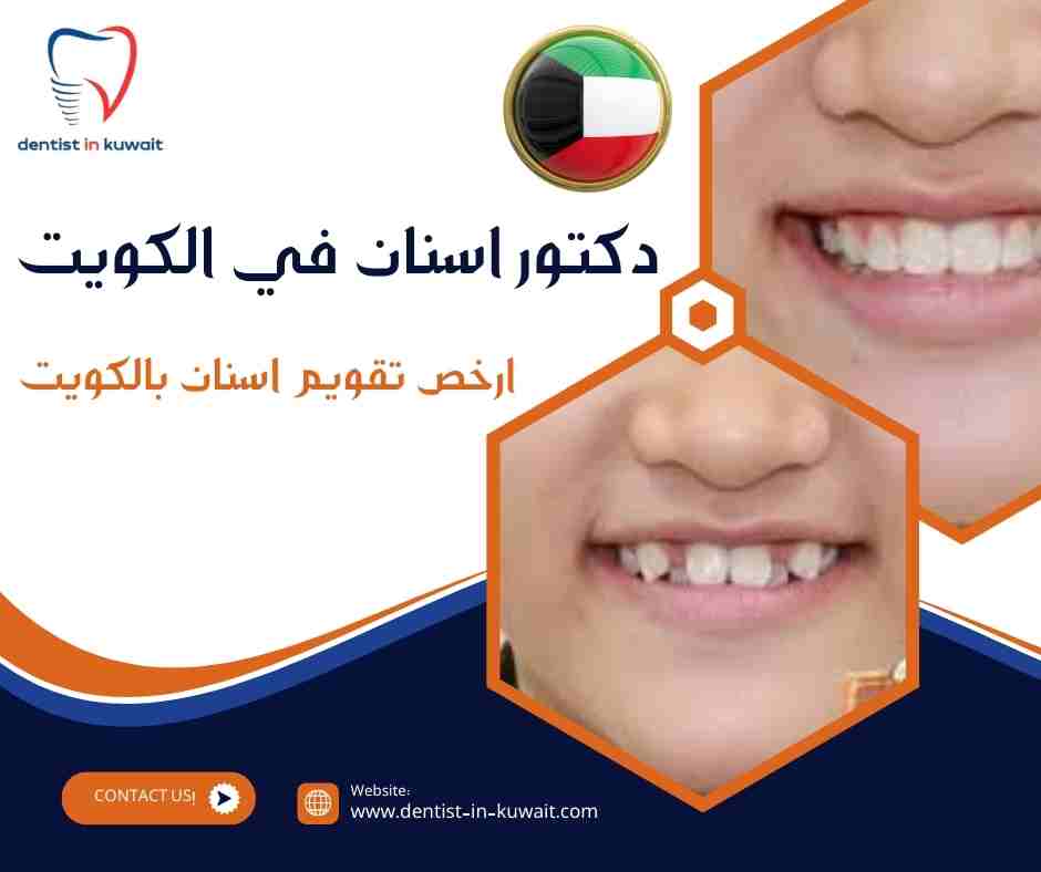ارخص تقويم اسنان بالكويت