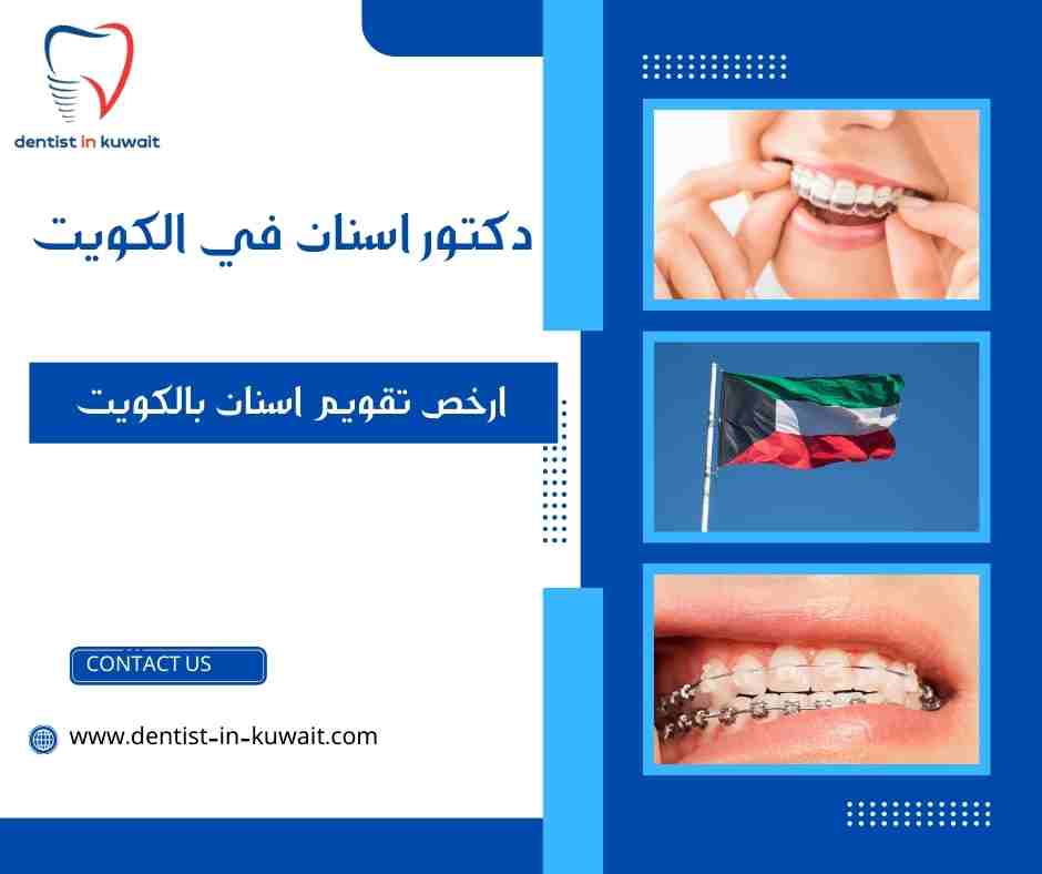 ارخص تقويم اسنان بالكويت