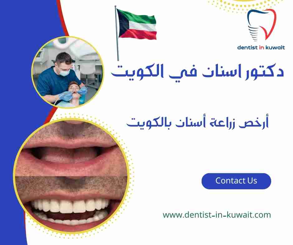 أرخص زراعة أسنان بالكويت