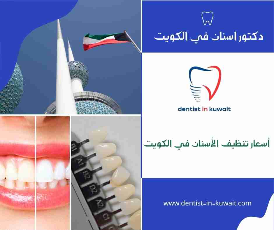 أسعار تنظيف الأسنان في الكويت