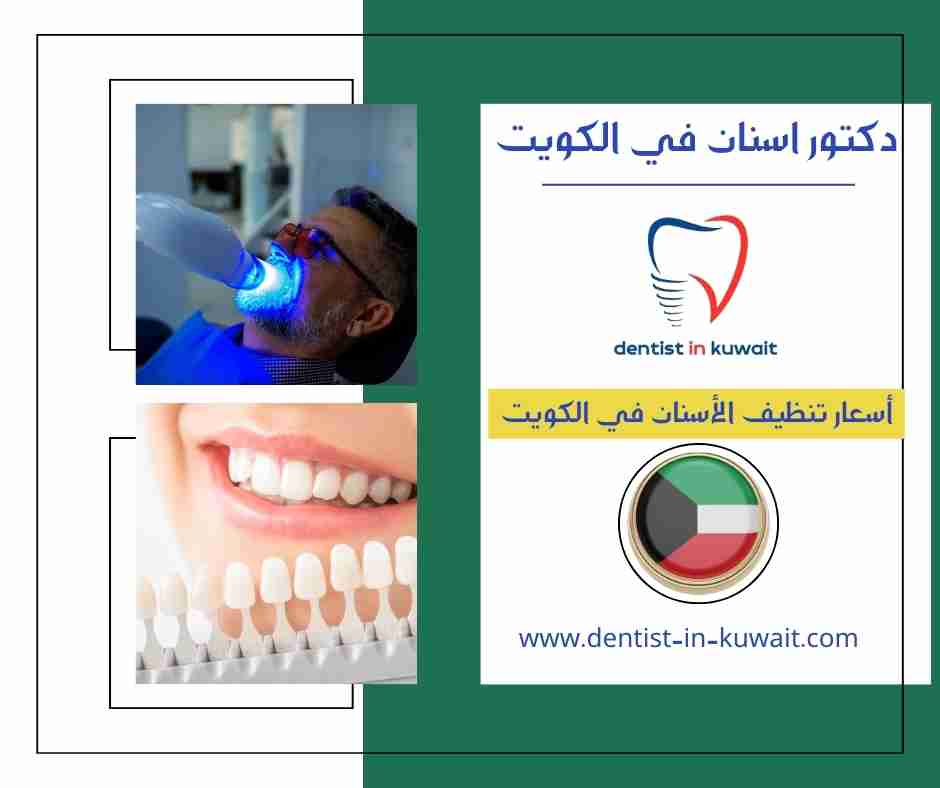 أسعار تنظيف الأسنان في الكويت