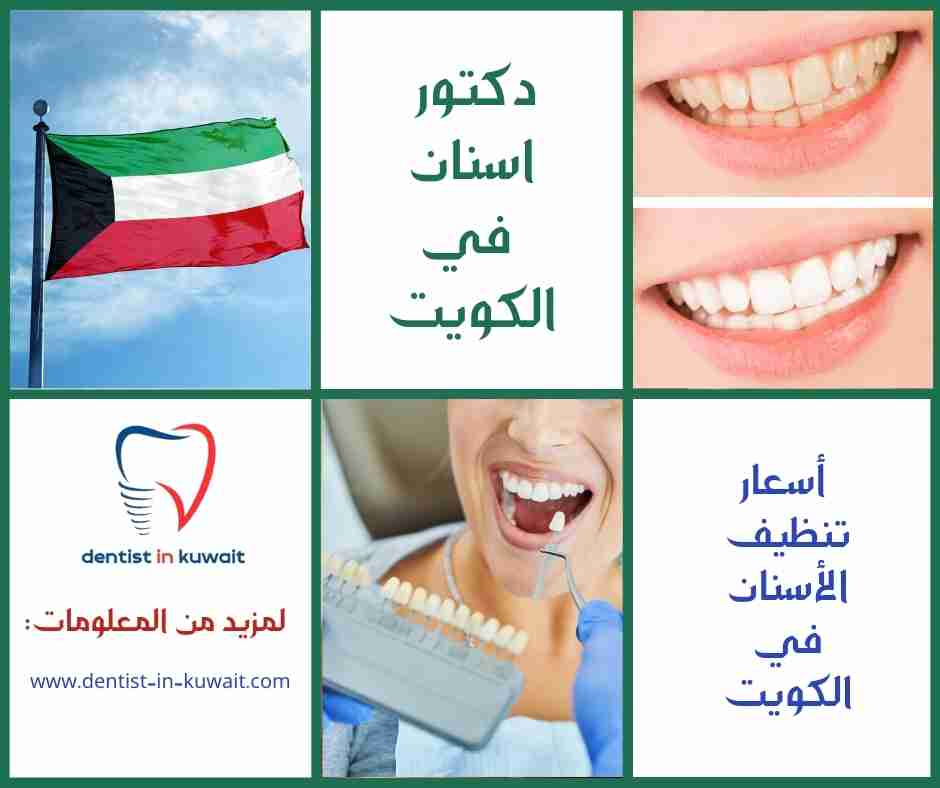 أسعار تنظيف الأسنان في الكويت