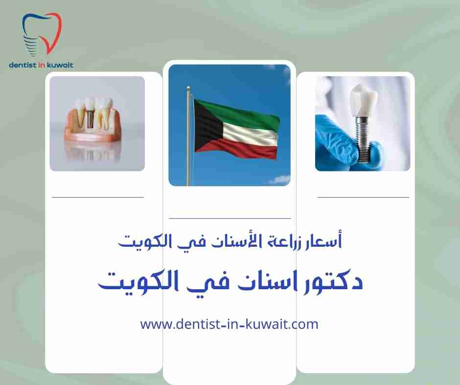 أسعار زراعة الأسنان في الكويت