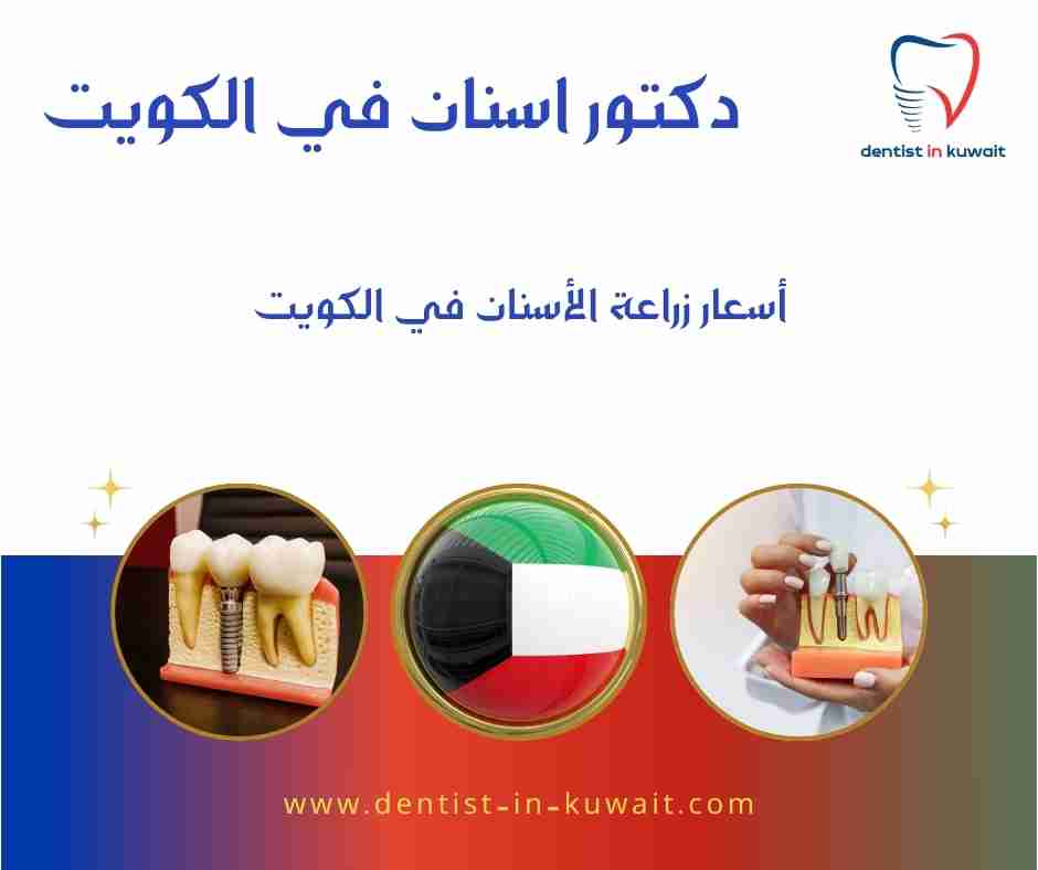 أسعار زراعة الأسنان في الكويت