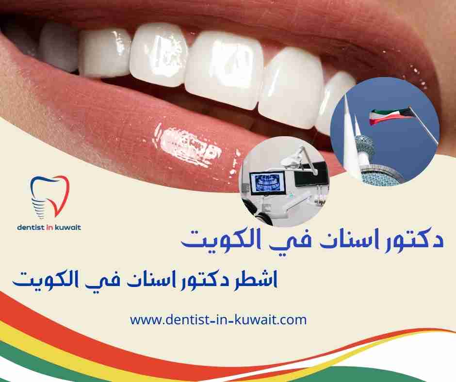 اشطر دكتور اسنان في الكويت