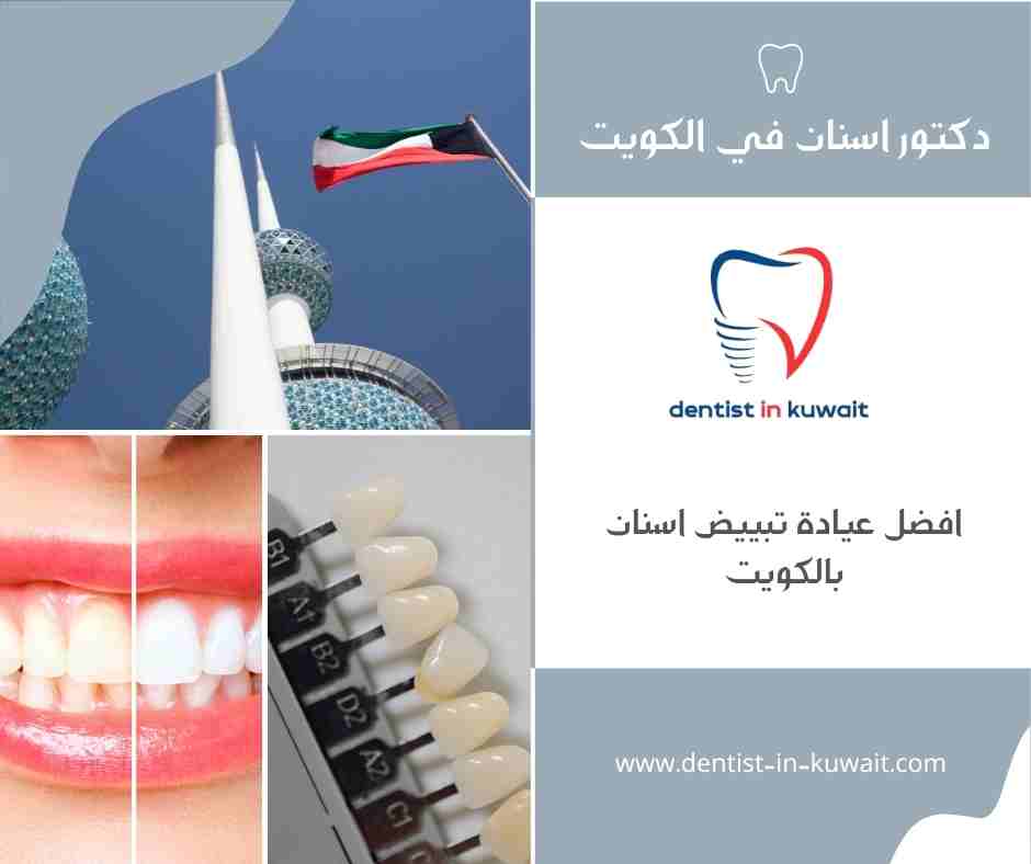 افضل عيادة تبييض اسنان بالكويت