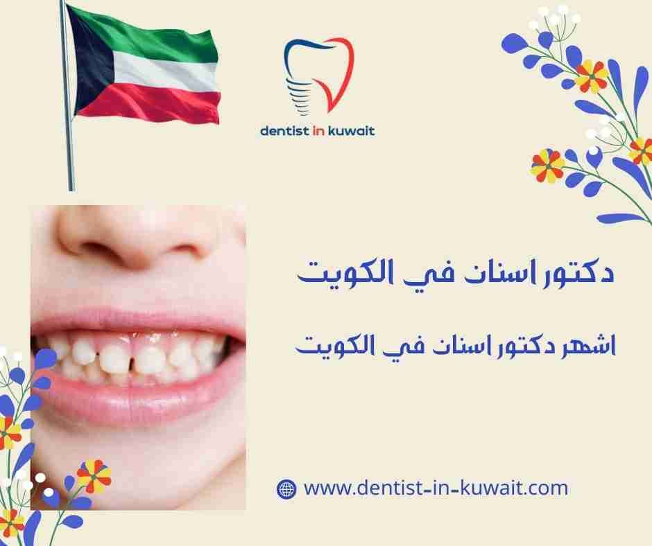 اشهر دكتور اسنان في الكويت