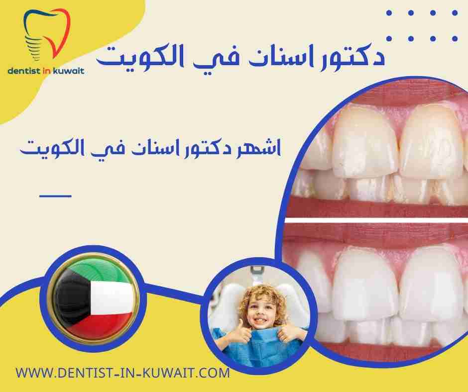 اشهر دكتور اسنان في الكويت