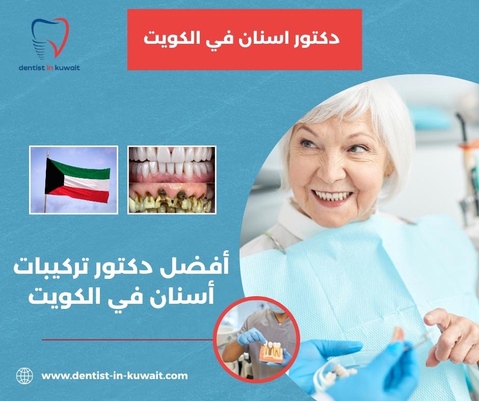 أفضل دكتور تركيبات أسنان في الكويت