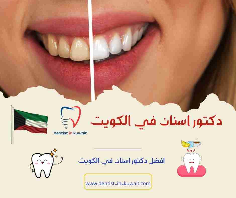 افضل دكتور اسنان في الكويت