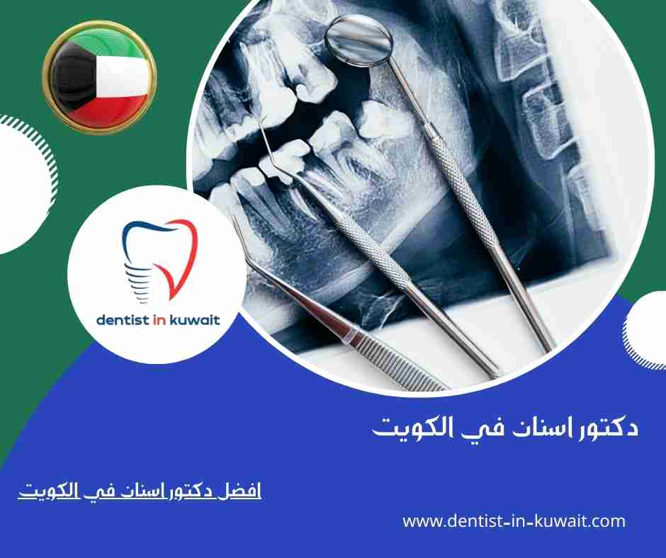 افضل دكتور اسنان في الكويت