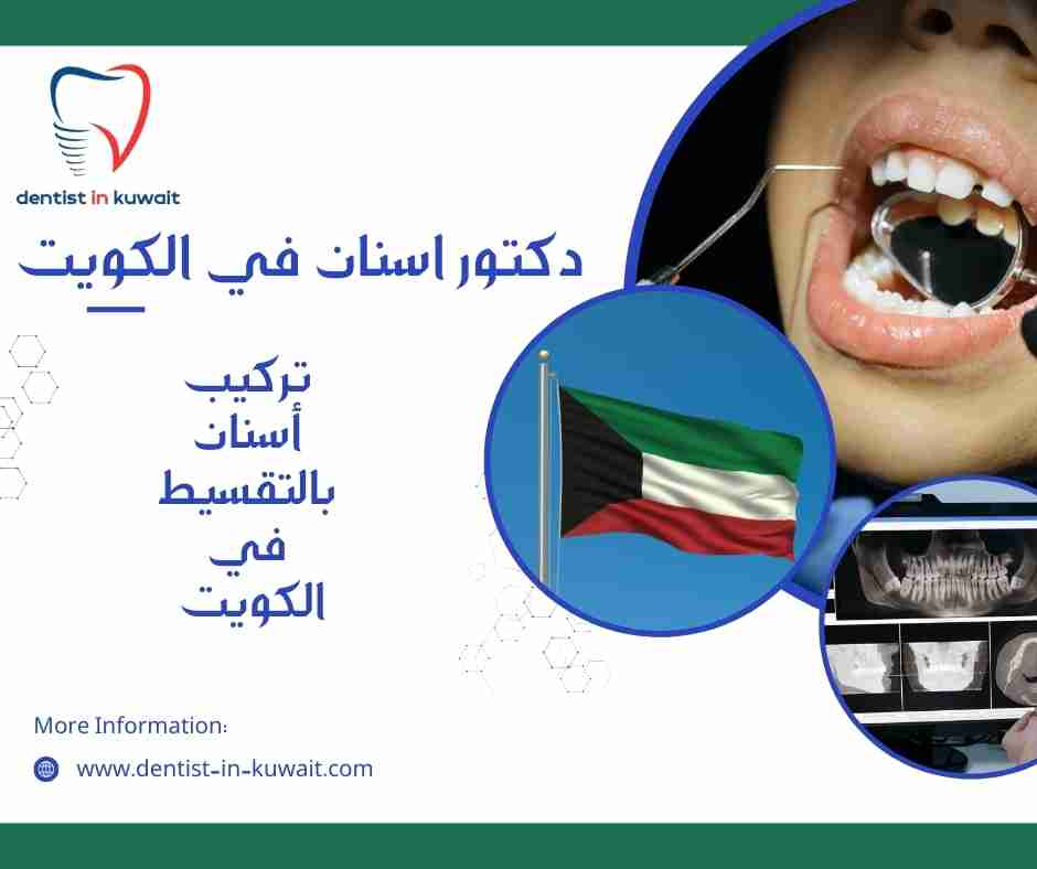 تركيب أسنان بالتقسيط في الكويت