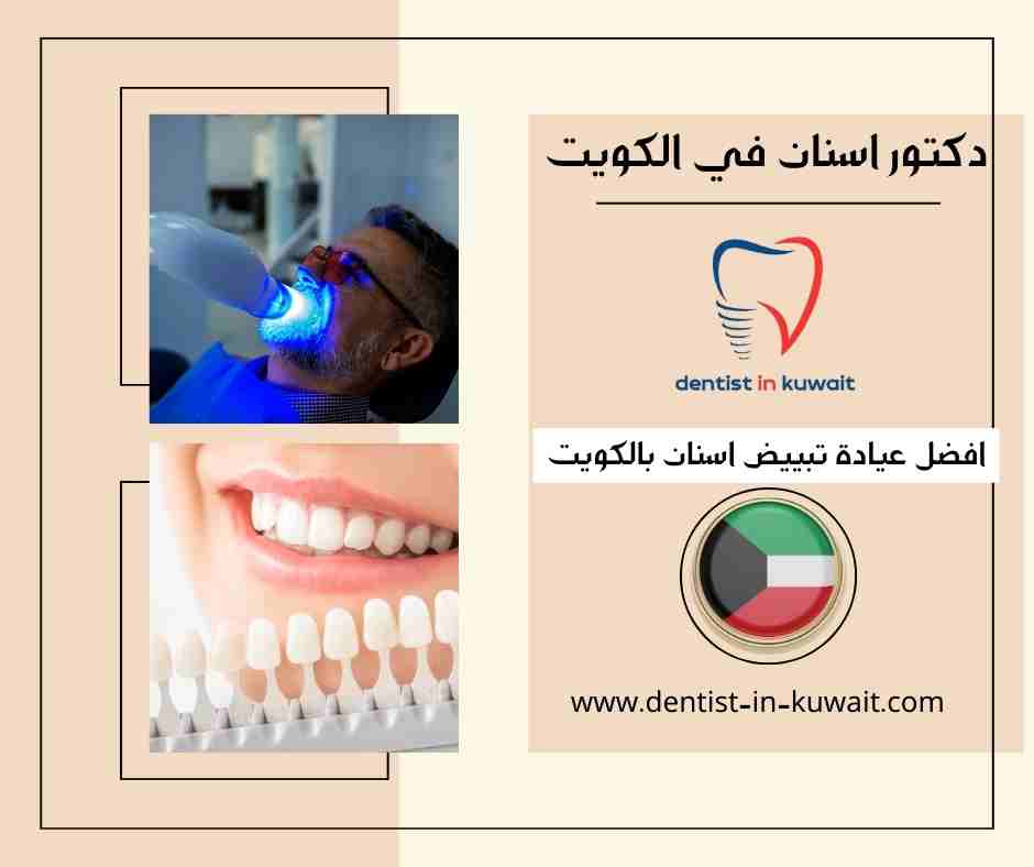 افضل عيادة تبييض اسنان بالكويت