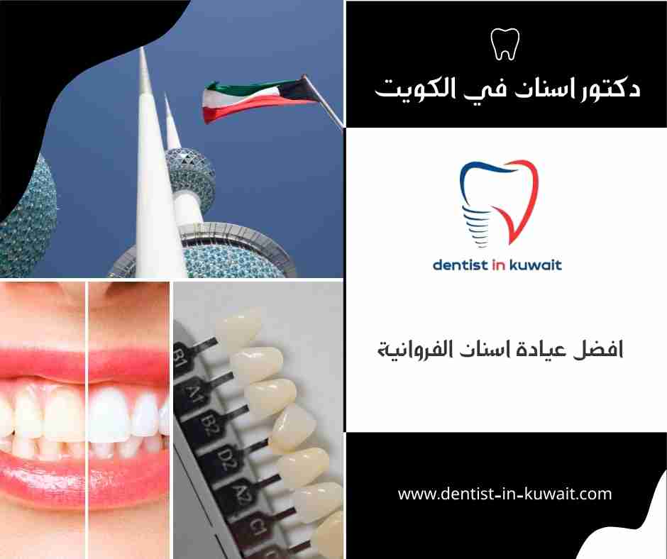 افضل عيادة اسنان الفروانية