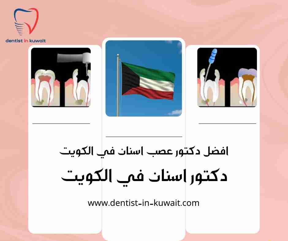 افضل دكتور عصب اسنان في الكويت