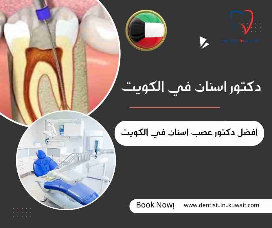 افضل دكتور عصب اسنان في الكويت