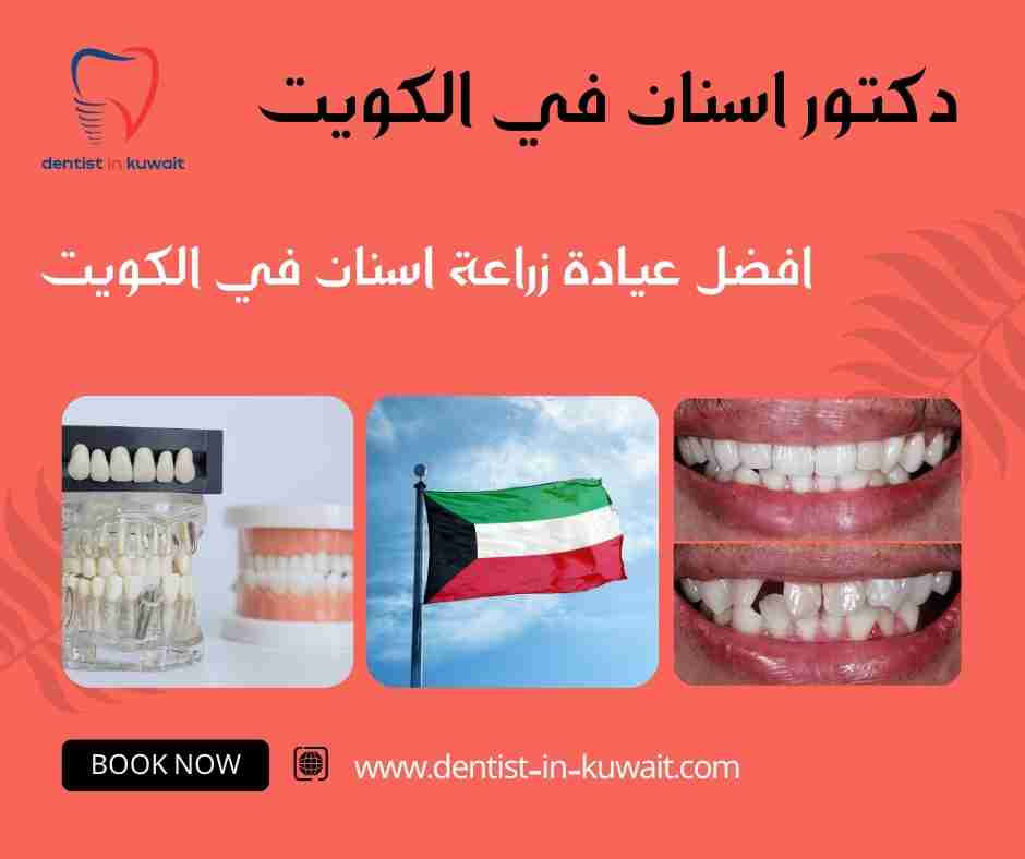 افضل عيادة زراعة اسنان في الكويت