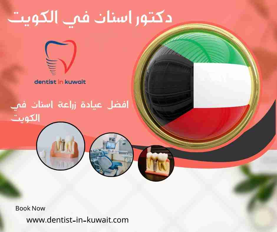 افضل عيادة زراعة اسنان في الكويت
