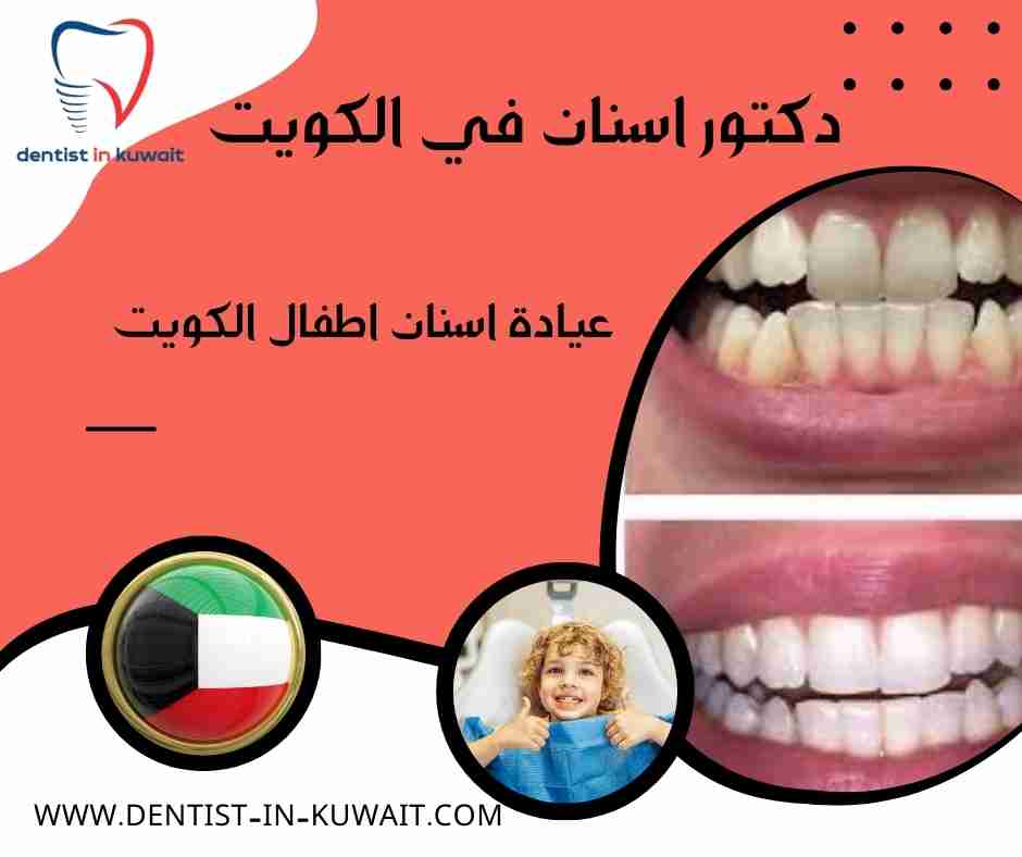 عيادة اسنان اطفال الكويت