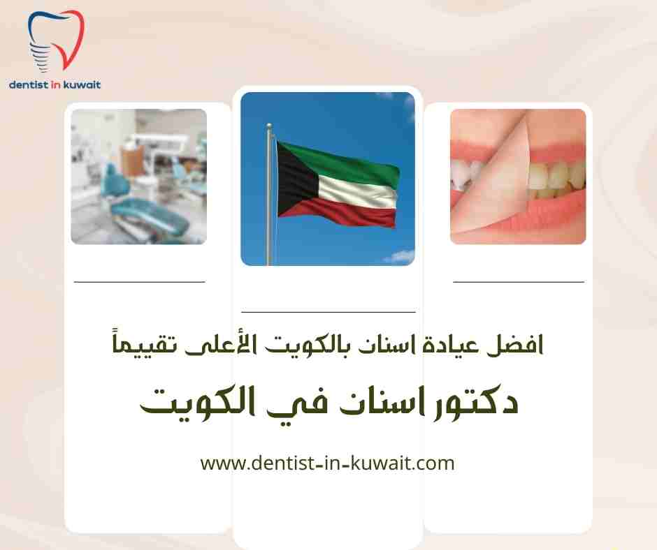 افضل عيادة اسنان بالكويت الأعلى تقييماً