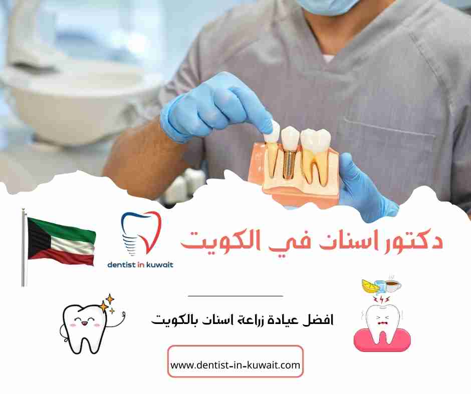 افضل عيادة زراعة اسنان بالكويت
