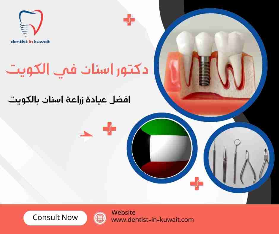 افضل عيادة زراعة اسنان بالكويت