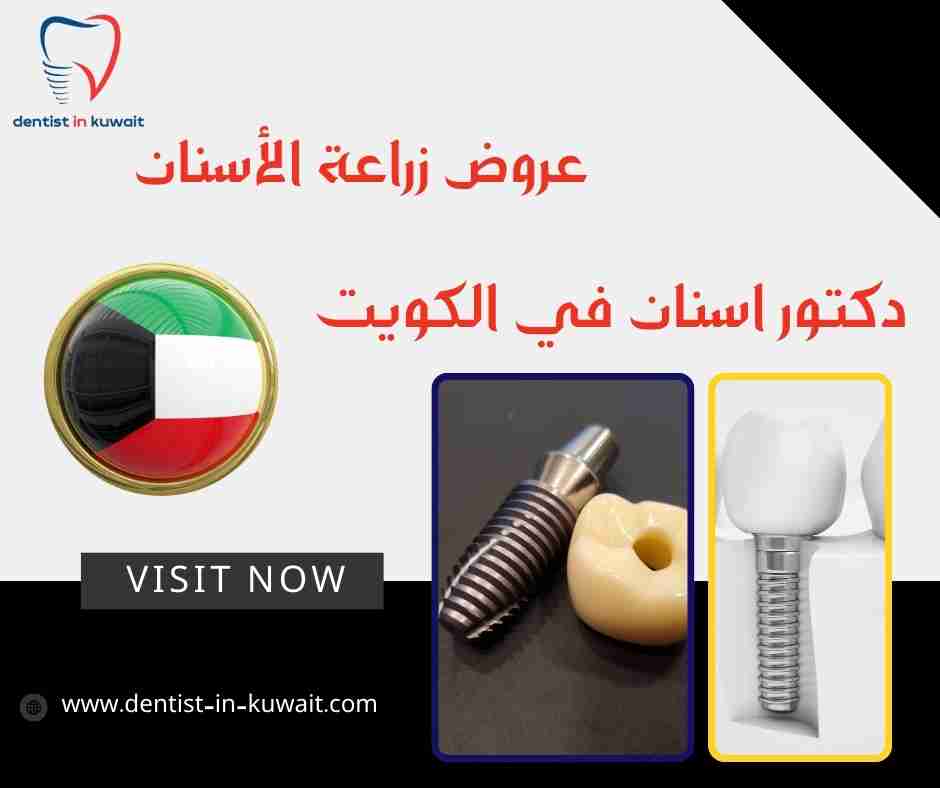 عروض زراعة الأسنان