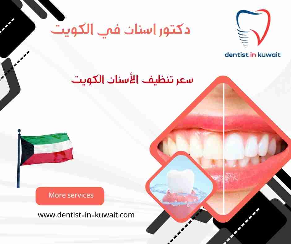 سعر تنظيف الأسنان الكويت