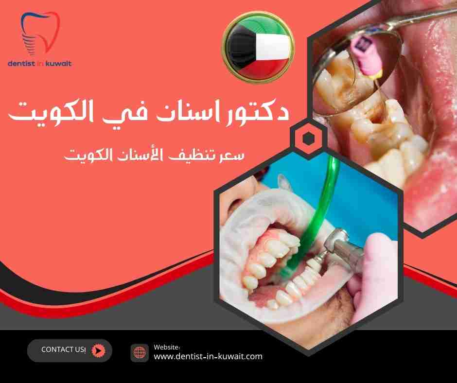 سعر تنظيف الأسنان الكويت