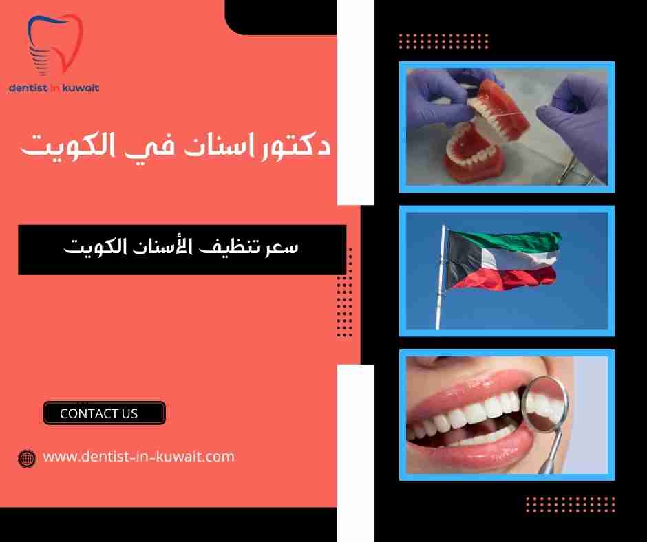 سعر تنظيف الأسنان الكويت