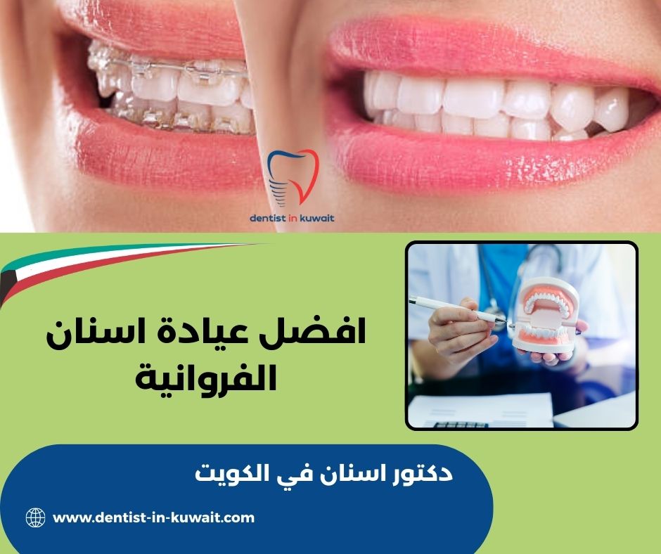 افضل عيادة اسنان في الفروانيه افضل عيادة اسنان في الفروانيه