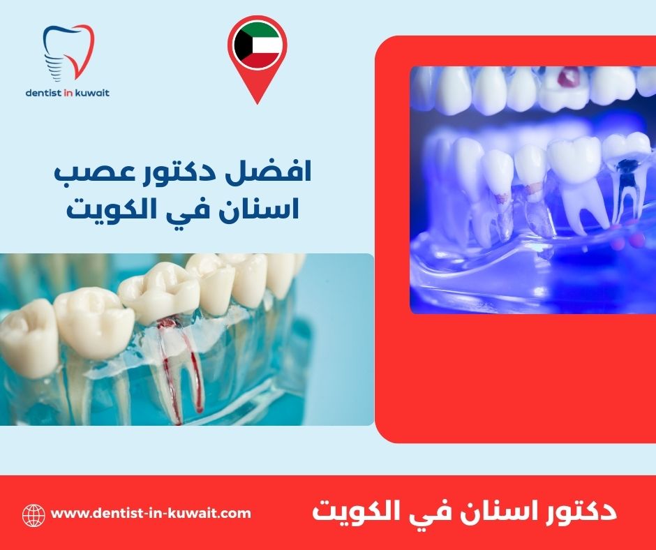 افضل دكتور عصب اسنان في الكويت