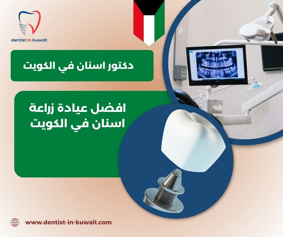 افضل عيادة زراعة اسنان بالكويت افضل عيادة زراعة اسنان بالكويت