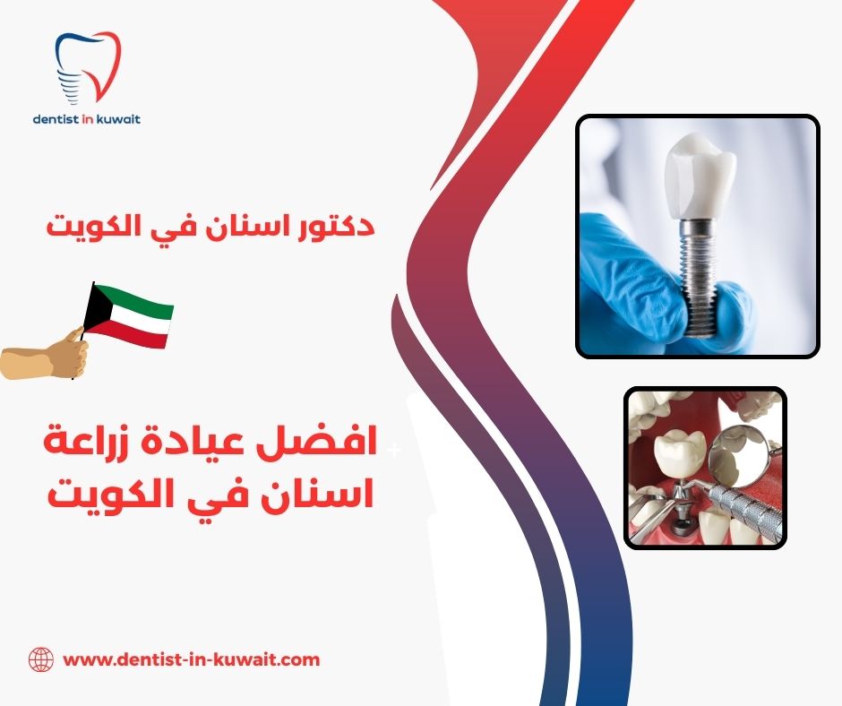 أفضل زراعة أسنان في الكويت أفضل زراعة أسنان في الكويت