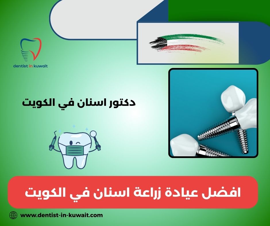 أفضل عيادة زراعة أسنان في الكويت أفضل عيادة زراعة أسنان في الكويت