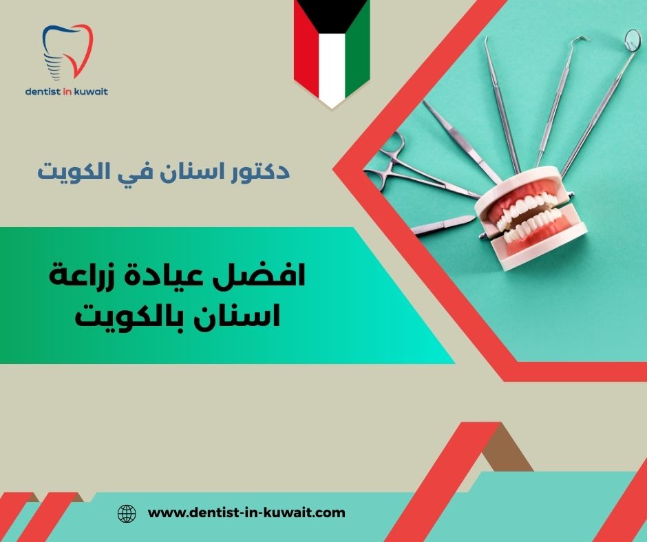 أفضل زراعة أسنان في الكويت