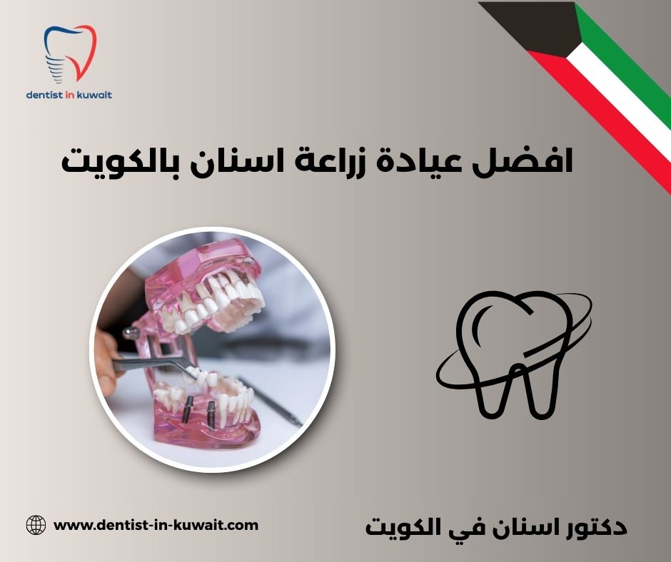 عيادة زراعة اسنان بالكويت