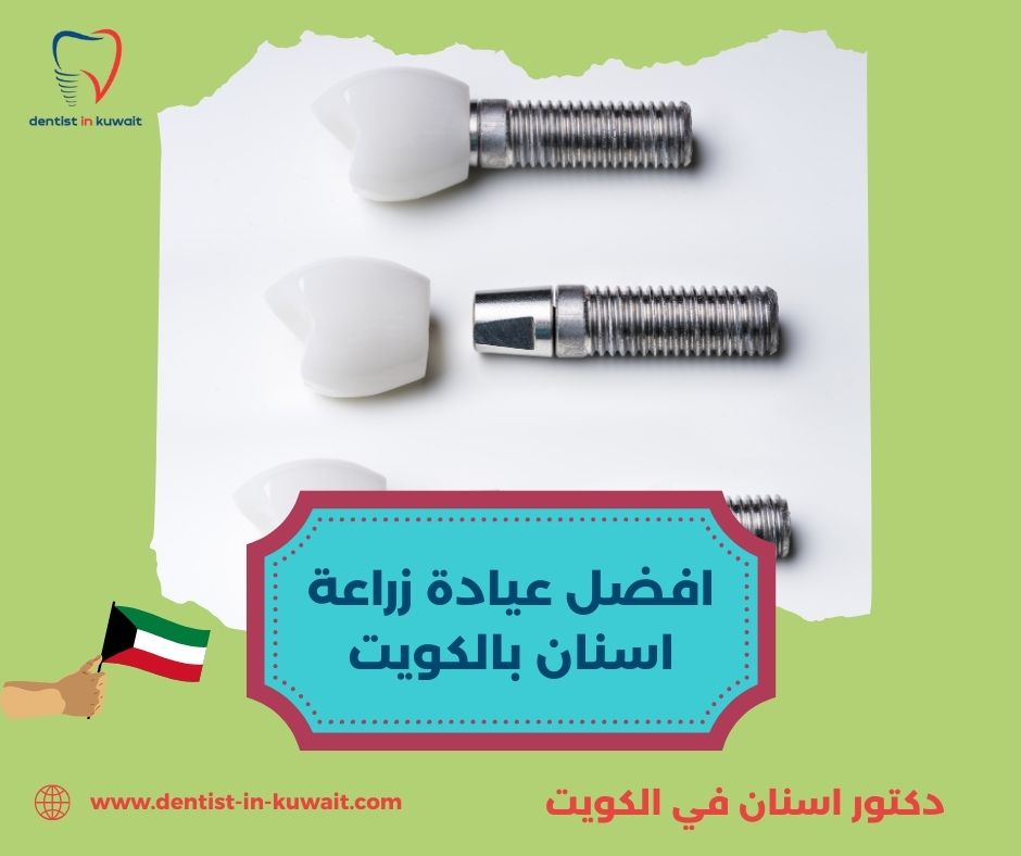 افضل عيادة زراعة اسنان في الكويت