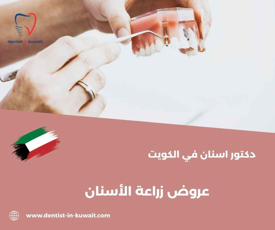 أسعار عيادات الأسنان في الكويت