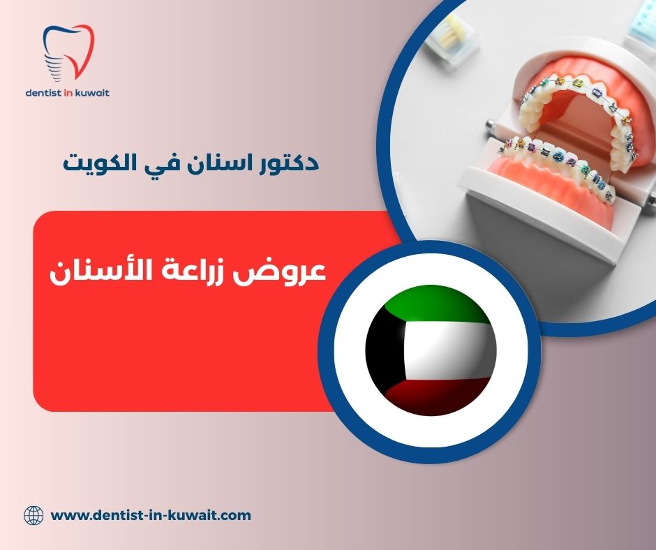 عروض زراعة الأسنان