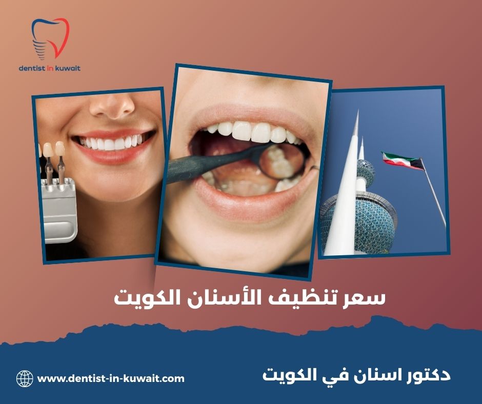 سعر تنظيف الاسنان في الكويت